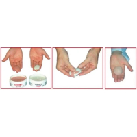 Fresco DUO 10 rosé professionele silicone voor zachte orthesen op maat– 2x100gr