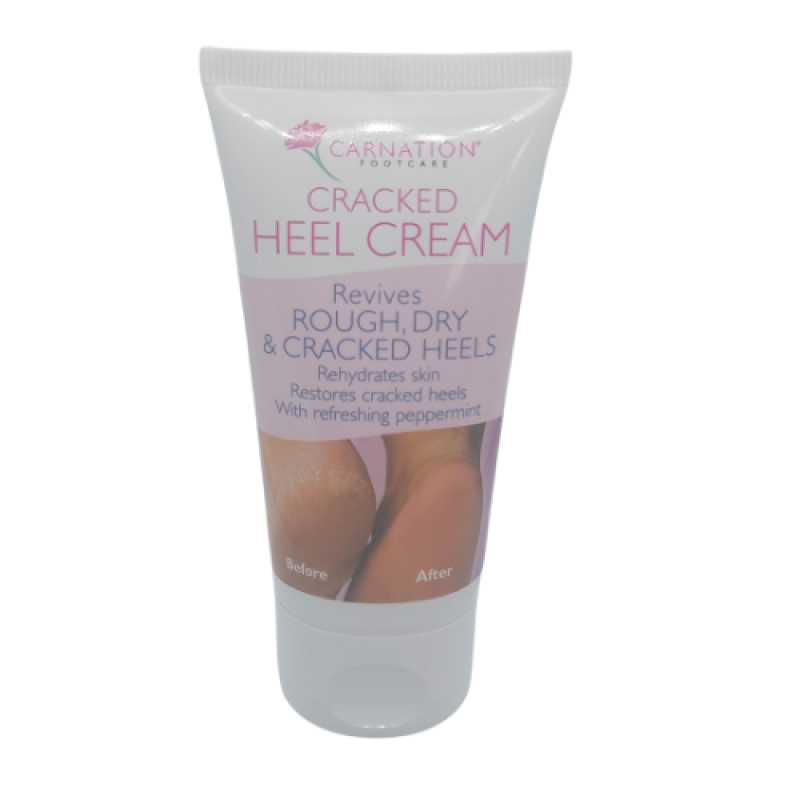Carnation Cracked Heel Cream 50ml met 20% Ureum en Pepermunt