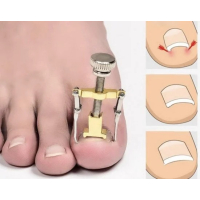 Lifte-ongles (ongle incarné) Dr. Matsu Misubizu