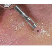 Trepaan glad - Ø 2.3 mm - Edenta