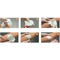 Opsite Flexifix 10 cm × 10 m – transparante fixatiefilm 